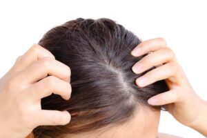 yong-woman-hand-itchy-scalp-dandruff-problem-hair-2021-09-01-17-49-24-utc